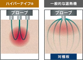 「温め」の効果